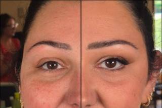 Derm'up - 5
