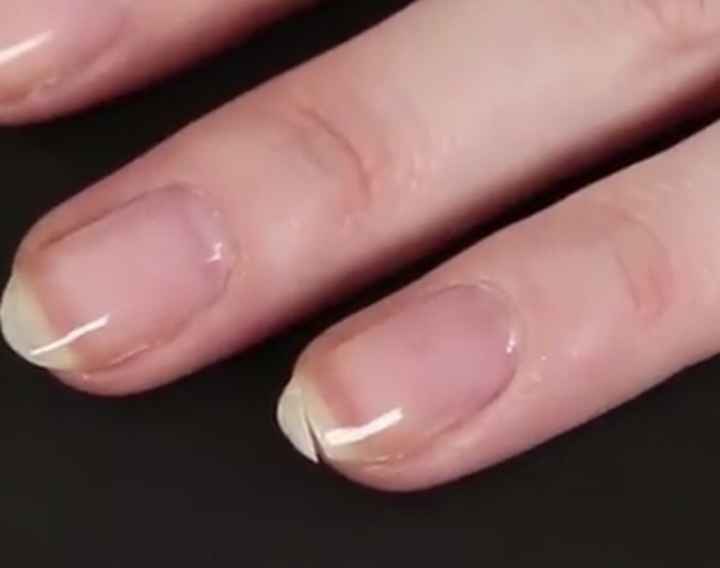 Ongles cassés? Astuce magique - 1