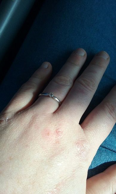 Demande en mariage : avez-vous eu la bague de vos rêves ? - 1