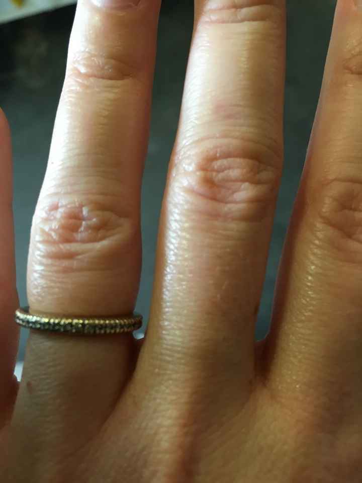 Ça fait pas mariage / bague de fiançailles... - 1