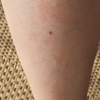 Bandes de cires froides et tâches - 1