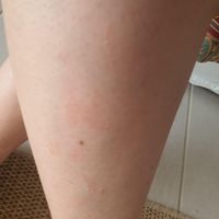 Bandes de cires froides et tâches - 2