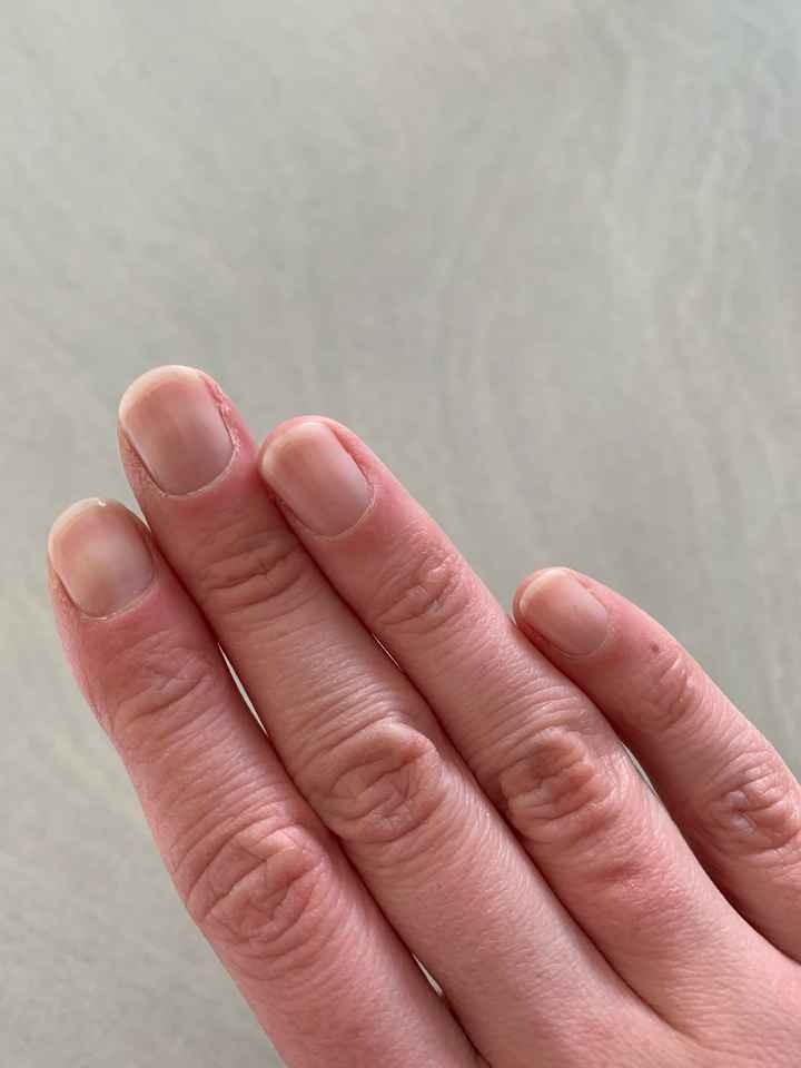 Ongles cassants : solution - 2