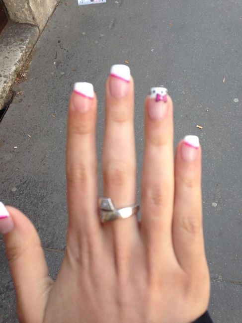 ongles