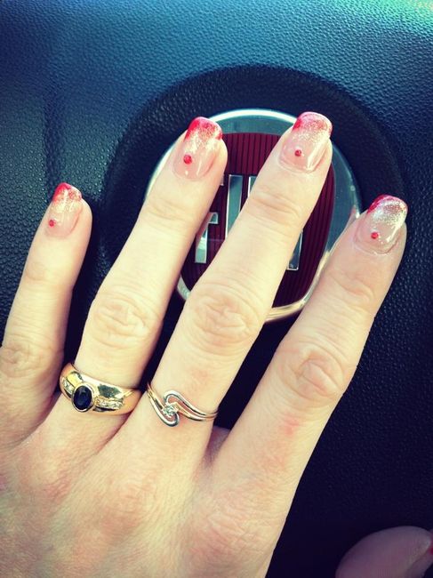ongles