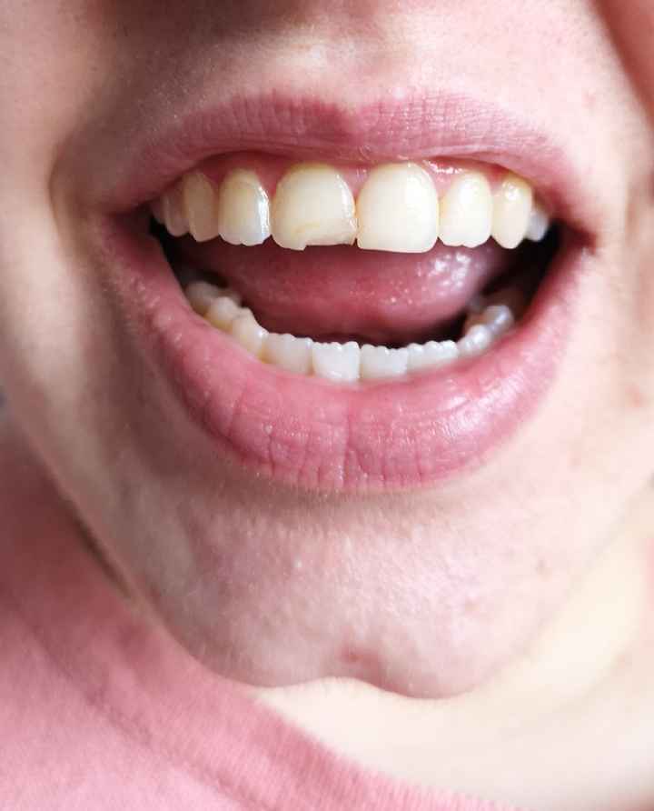 J-11 urgence dentiste.... 😭 - 1