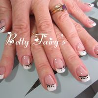 ongle
