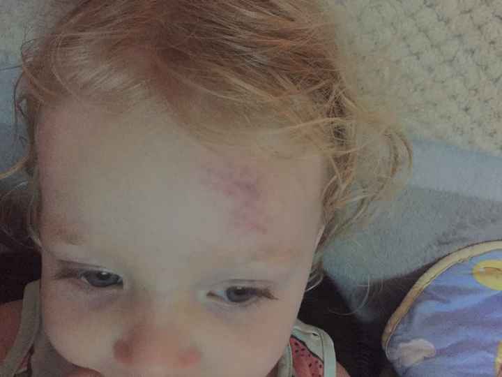 Besoin de conseils des mamans de petits bout casse-cou - 1