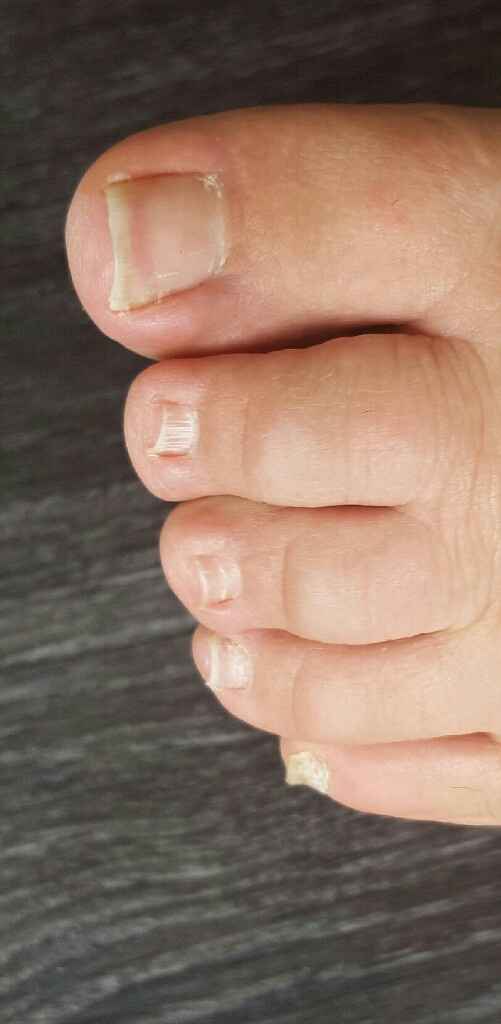 Beauté  des pieds - 1