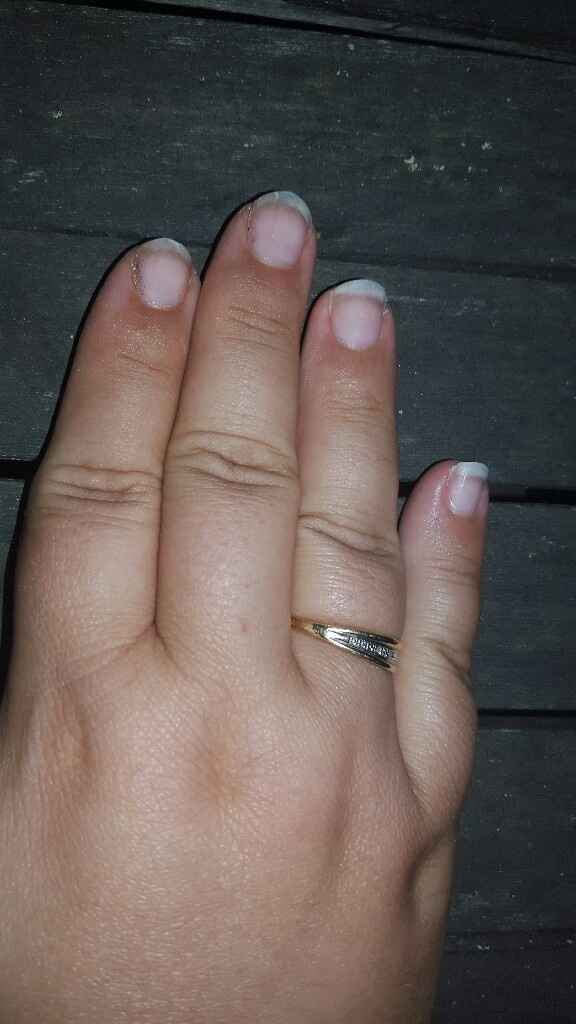 Trop dégoûtée !!!!!!! mes ongles - 1