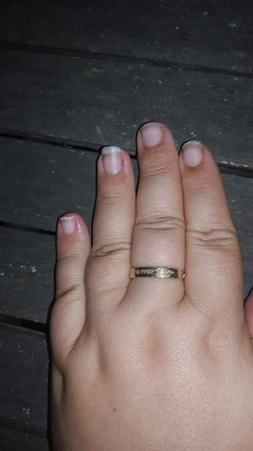 Trop dégoûtée !!!!!!! mes ongles - 2