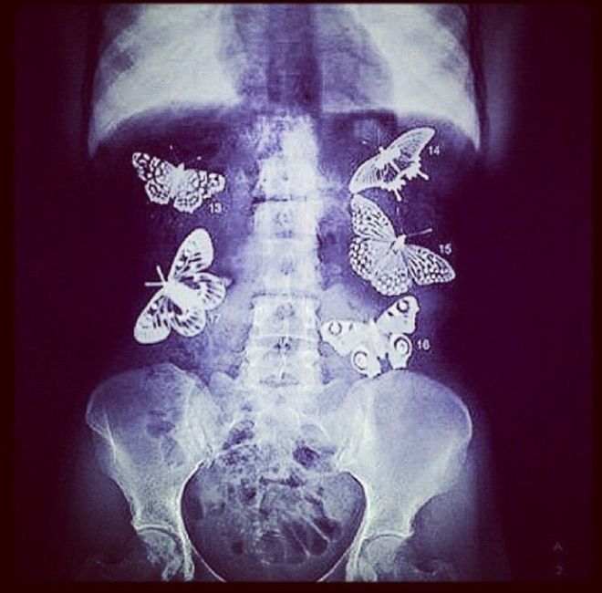 Pourquoi c'est lui - 1