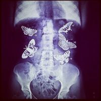 Pourquoi c'est lui - 1