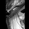 Laureen