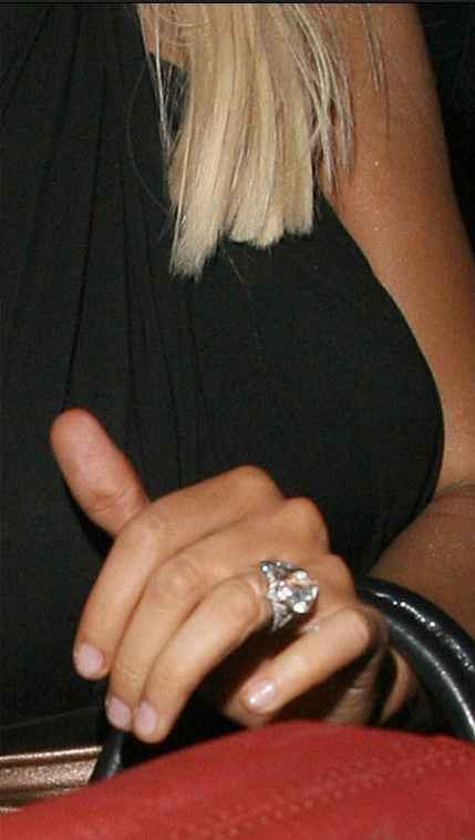 Bague 1