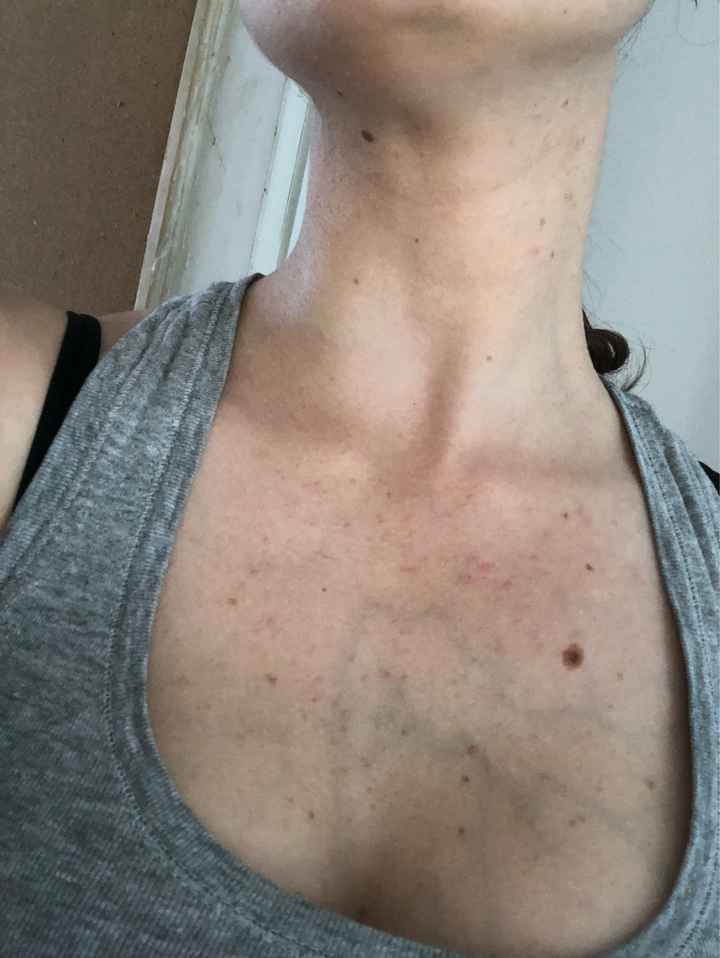 Help - 1