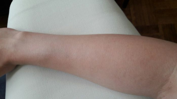 Epilation des bras? - 1