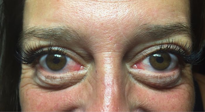 Extension de mes cils, trop contente - 2