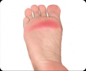 Chaussure de marié - 1
