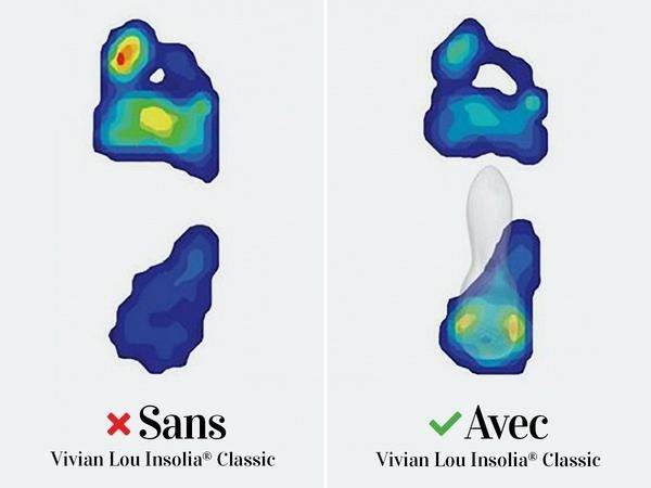 J'ai mal aux pieds ! - 1