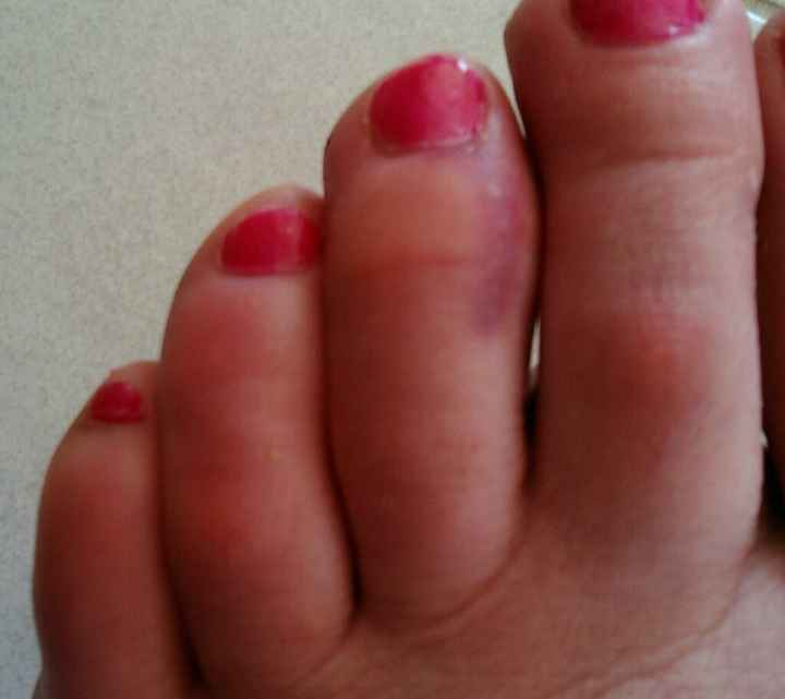 Evjf super mais douloureux - 1