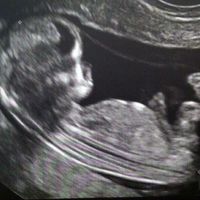 Test de grossesse positif...une nouvelle aventure commence!!! - 1