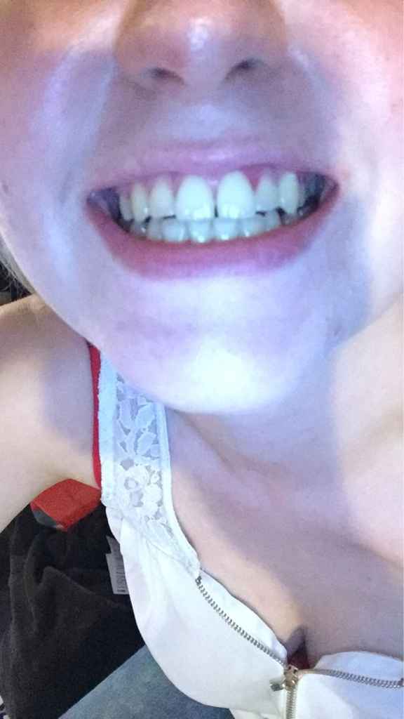 J'ai trouvé le produit pour blanchir les dents !!! - 2
