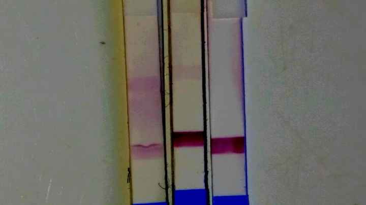 Besoin avis resultat tg - 1