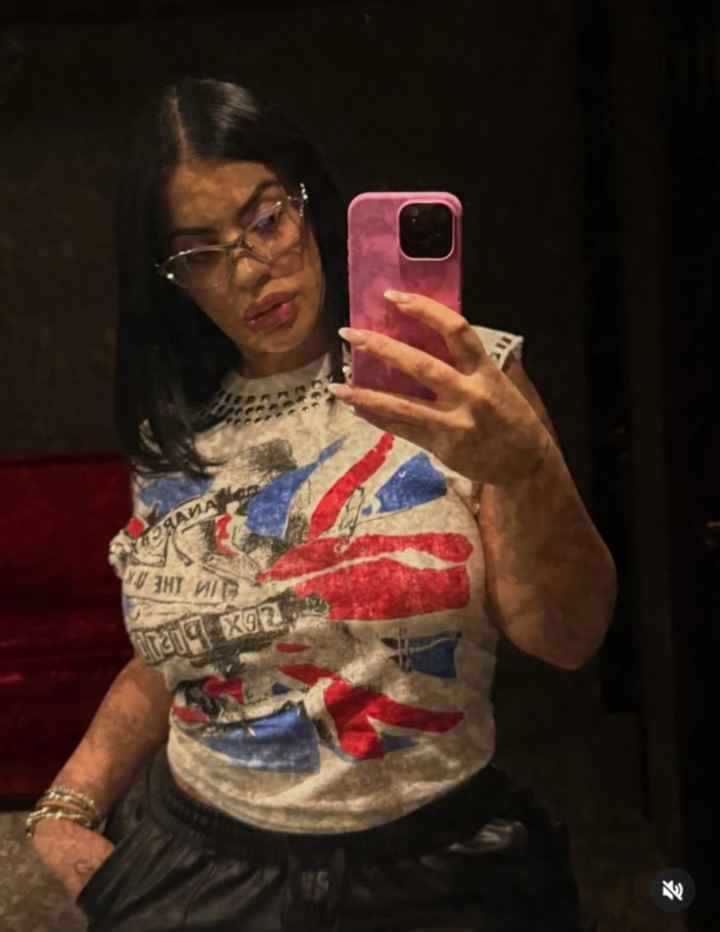 Emotional damage - 1