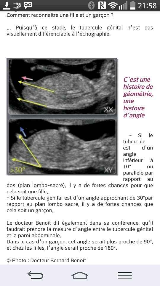 Lire une échographie - 1