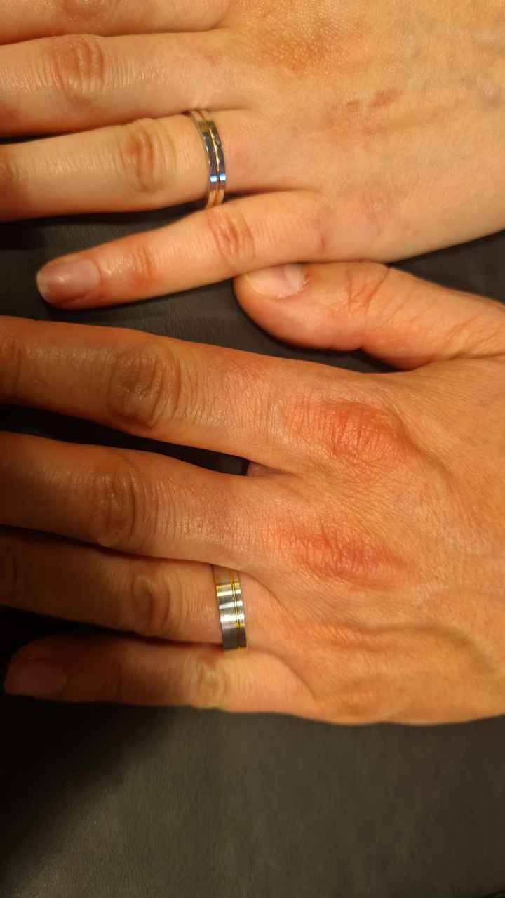 Montrez moi vos alliances!!! 🤗💍📸 - 2