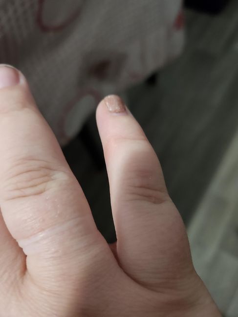 Alliance trop serrée ! 2