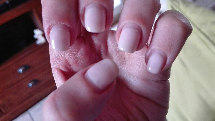 Ongles rongés - 1