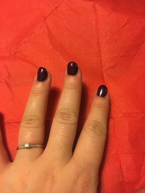 Ongles rongés - 1