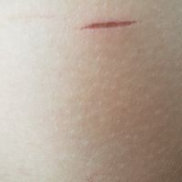 Jarretière ou pas Jarretière ? - 1