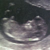 Notre premier bébé