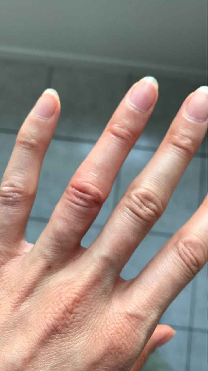 Ca m'a coûté un doigt! - 2