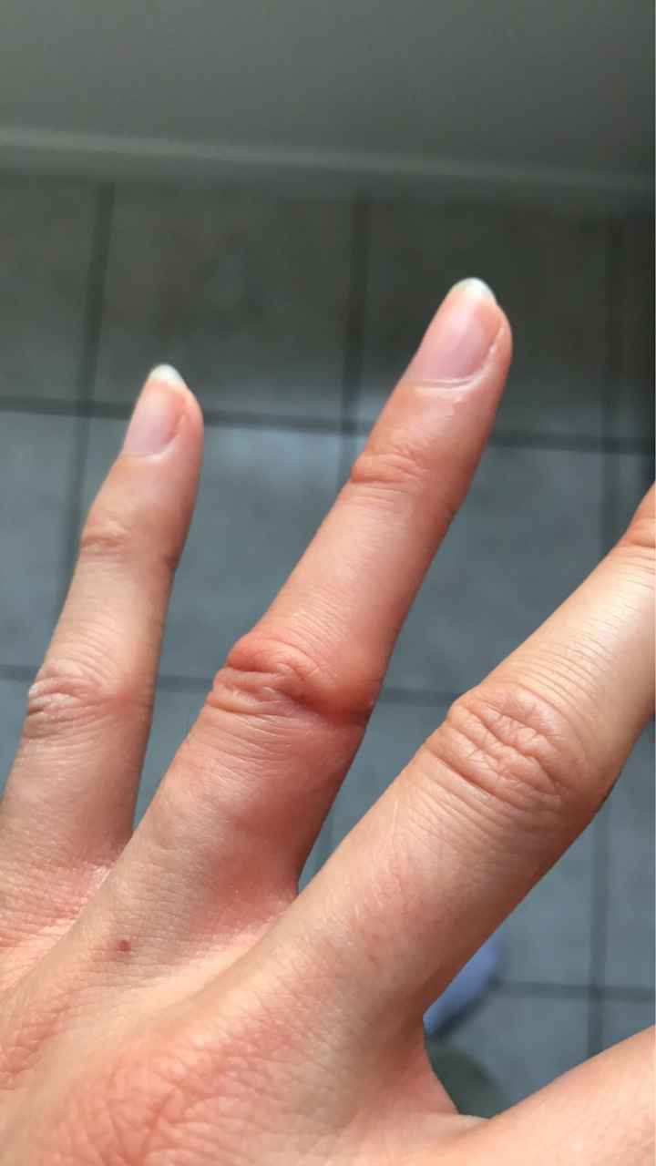 Ca m'a coûté un doigt! - 3