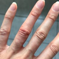 Ca m'a coûté un doigt! - 2