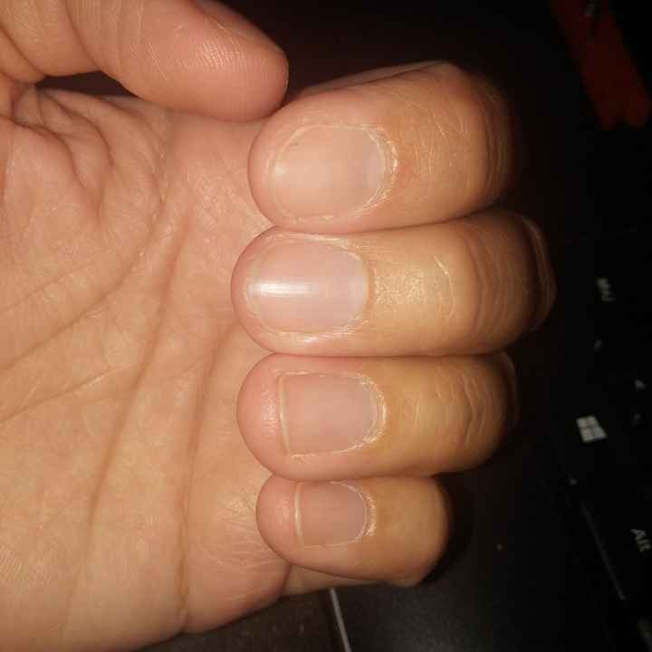 Ongles