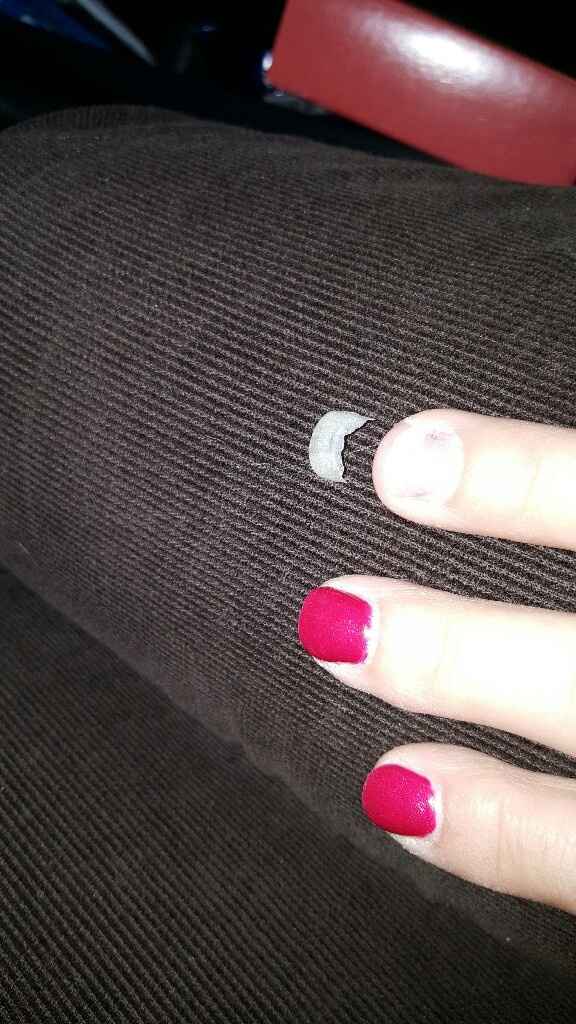 Ongles - 2