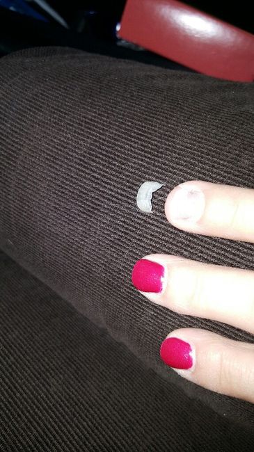 Ongles - 2