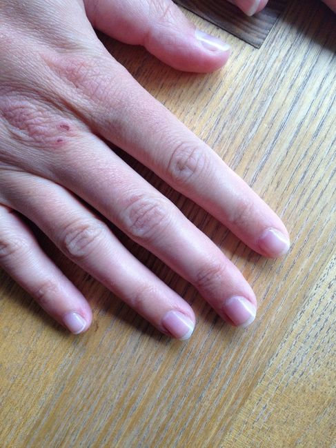ongles non rongés