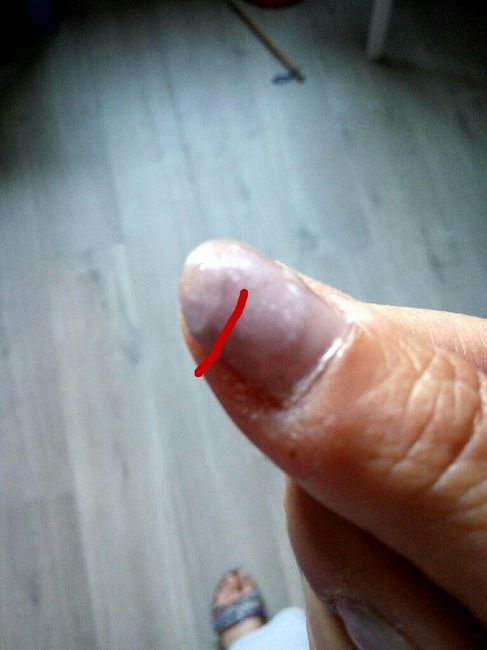 Tuiles en série à J-7 😭 - 1