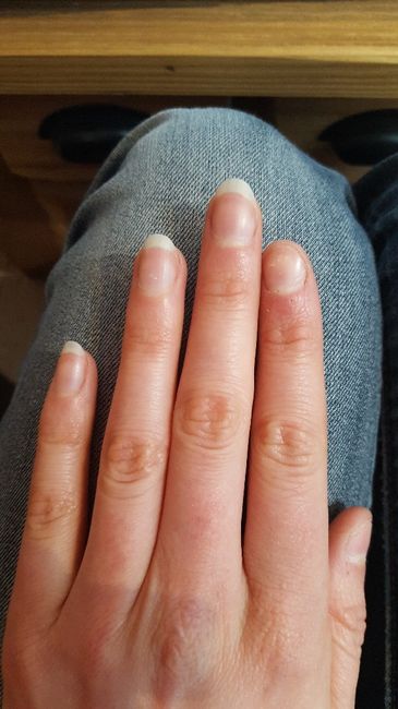 Arrêter de se ronger les ongles/la peau 2