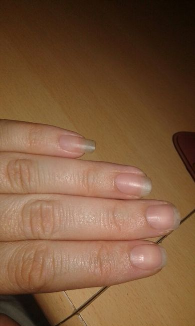 Trop dégoûtée !!!!!!! mes ongles - 2
