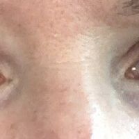 Extension de cils - 2