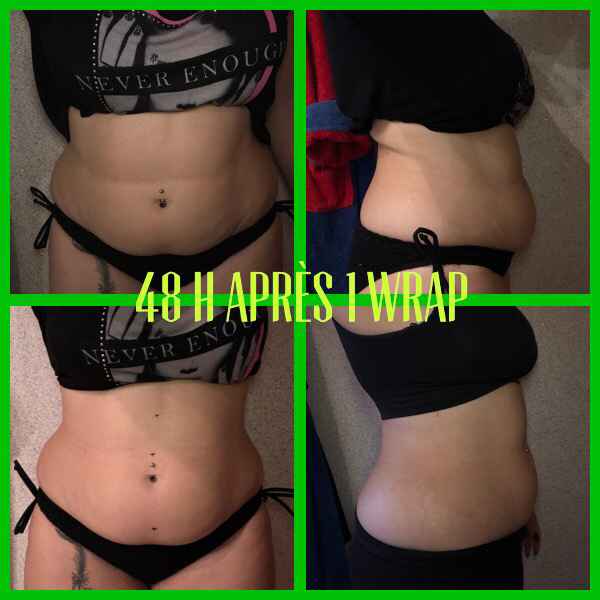 Opération peau ferme avant le jour j 💪🏼 - 1