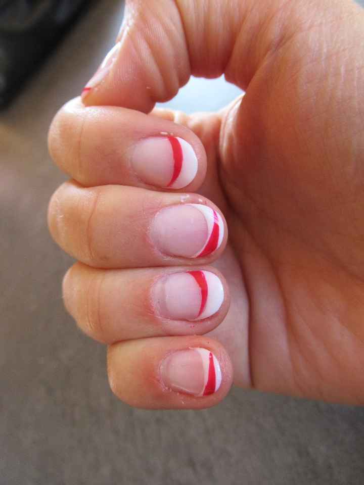 Ongles