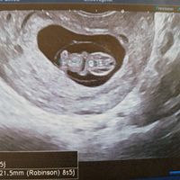 La suite logique ! - 3